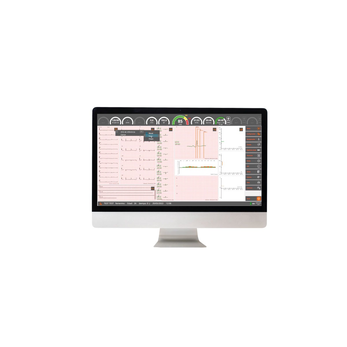 Software para la ejecución y la revisión de pruebas de esfuerzo