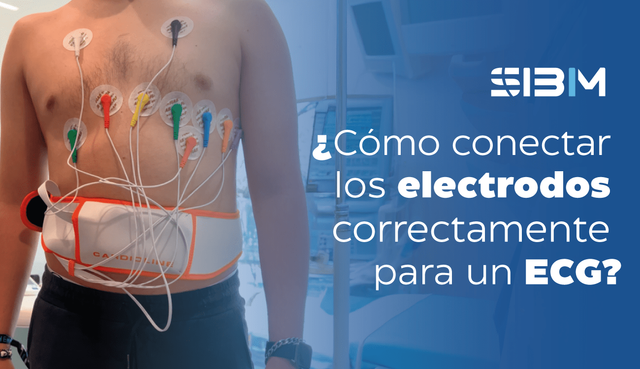 Conectar los electrodos correctamente para un ECG